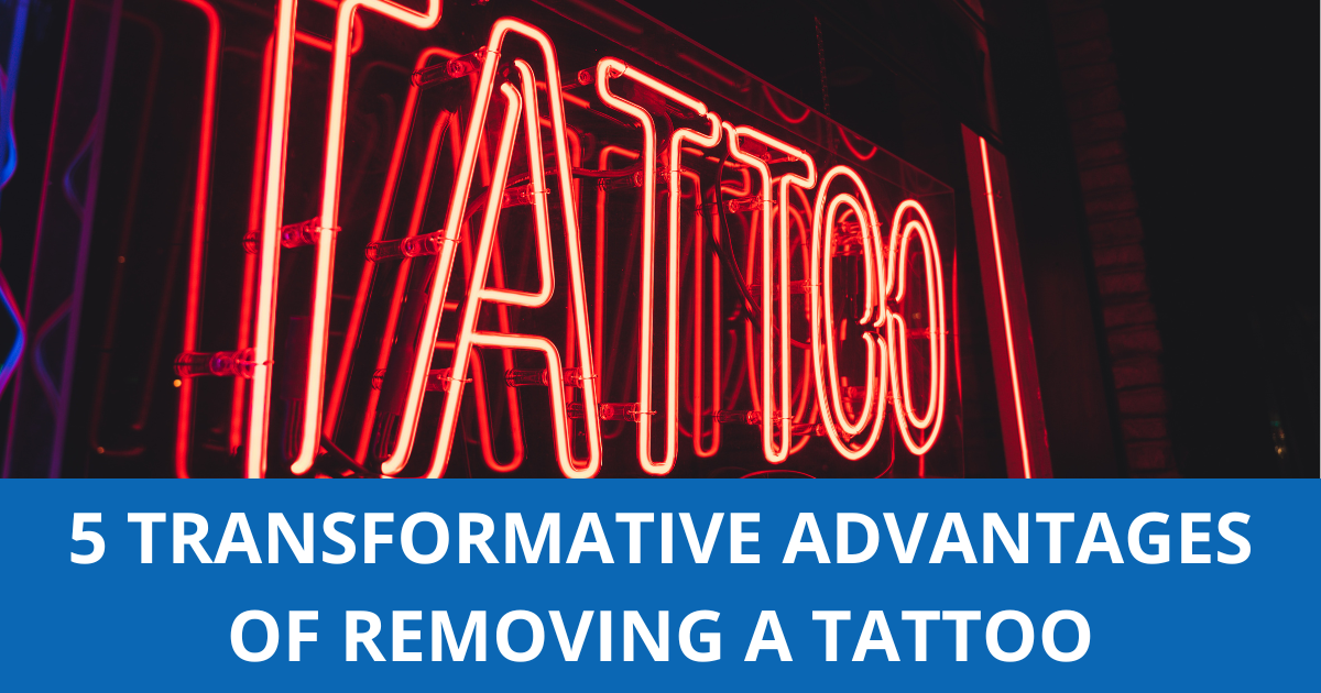 5 TRANSFORMATIVE ADVANTAGES OF REMOVING A TATTOO